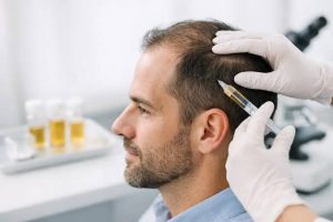 Why Professional Hair Loss Treatments Are Shifting Toward Regenerative Hair Solutions?